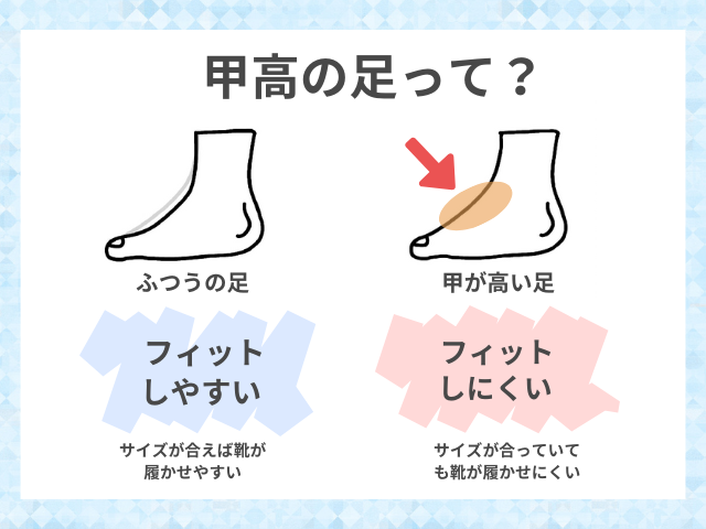 甲高の子どもの足と普通の足の違いを図で比較したイラスト